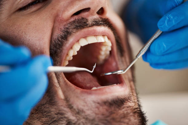 Best Broken or Cracked Tooth Emergency Dentist in Mount Healthy Heights, OH